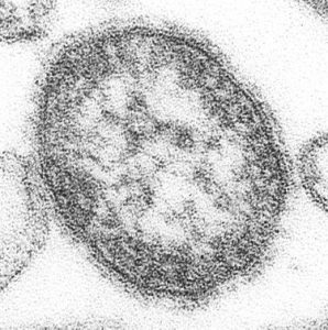375px-measles_virus